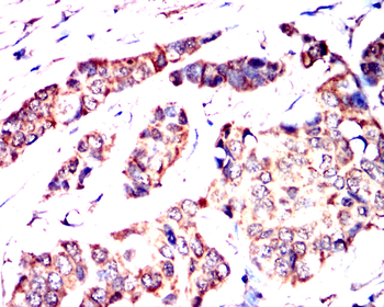 PIK3R1 Antibody