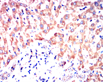 PIK3R1 Antibody