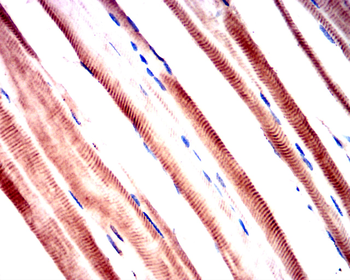 PIK3R1 Antibody