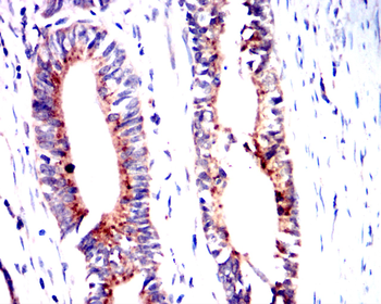 PIK3R1 Antibody