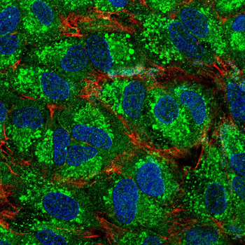 PIK3R1 Antibody