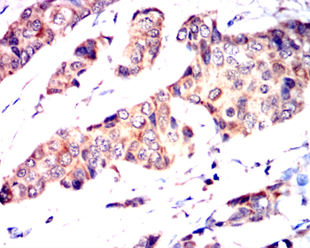 PIK3R1 Antibody