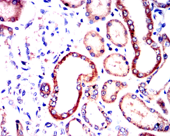 PIK3R1 Antibody