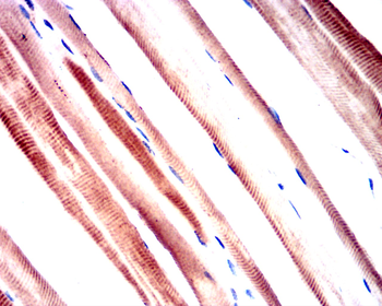 PIK3R1 Antibody
