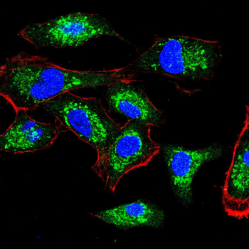 PIK3R1 Antibody