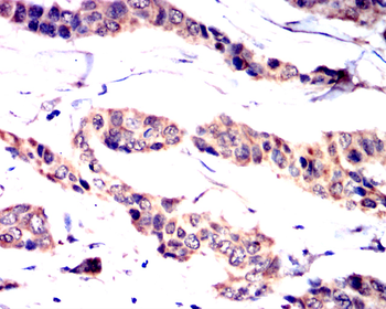 PIK3R1 Antibody
