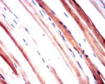 PIK3R1 Antibody