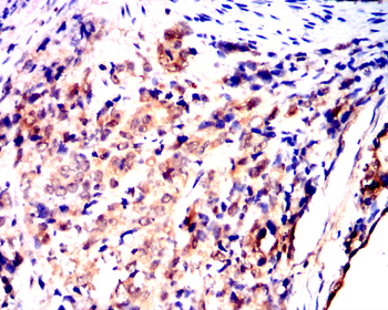 PIK3R1 Antibody