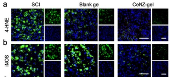 NOS2 Antibody