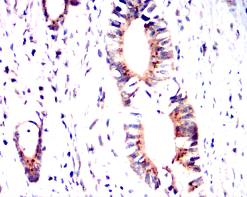 NFE2L2 Antibody
