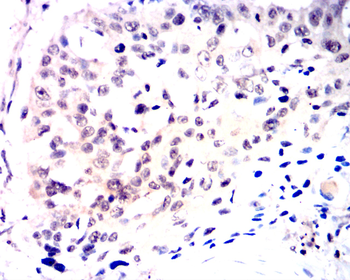 NFE2L2 Antibody