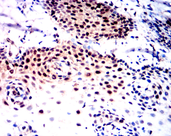 NFE2L2 Antibody