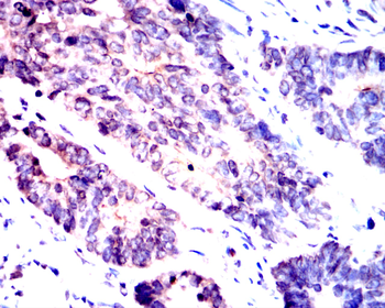 CCND1 Antibody
