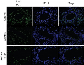 OCLN Antibody