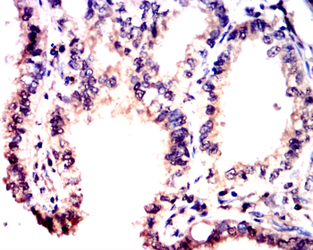CDKN1A Antibody