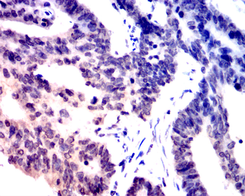 JUN Antibody