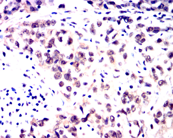 JUN Antibody