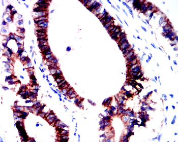SNAI1 Antibody