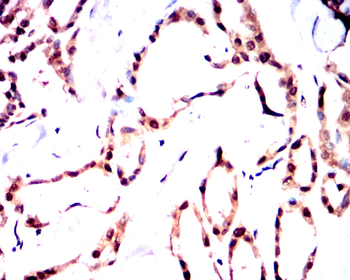 PPARA Antibody