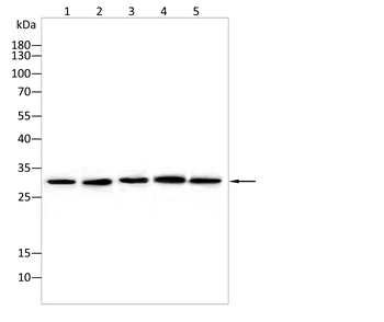 NQO1 Antibody