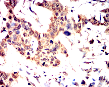 JAK2 Antibody