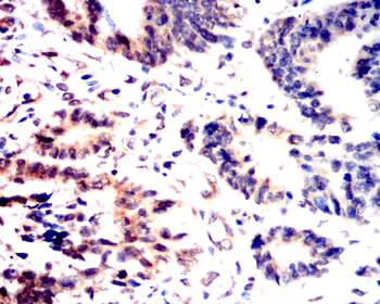 JAK2 Antibody