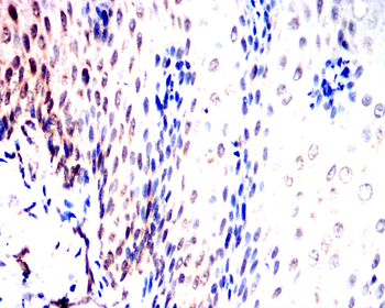 JAK2 Antibody