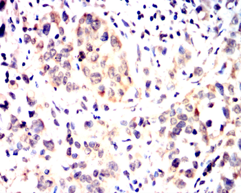 JAK2 Antibody