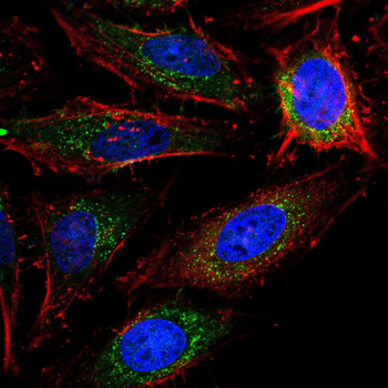 CCL2 Antibody