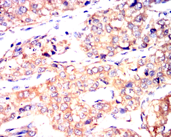 CCL2 Antibody