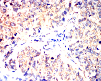 CCL2 Antibody