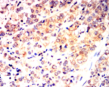 CCL2 Antibody