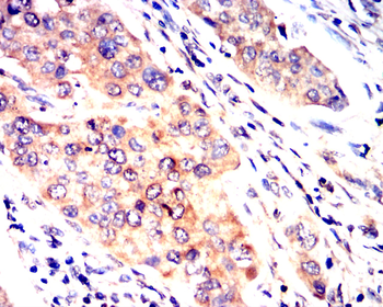 CCL2 Antibody