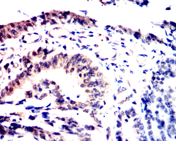 SNAI2 Antibody