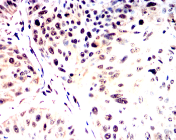 SNAI2 Antibody