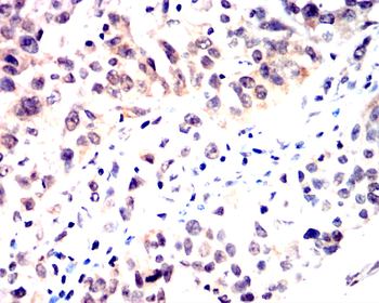 IRS1 Antibody