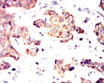 TBK1 Antibody