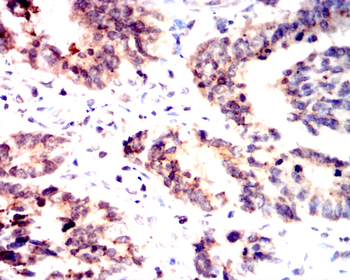 TBK1 Antibody
