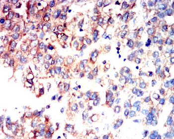 TBK1 Antibody