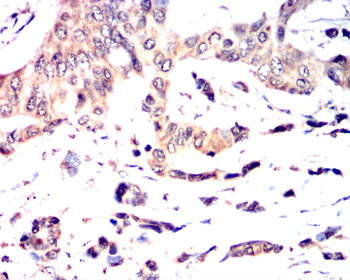 STAT1 Antibody