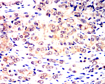 DNM1L Antibody