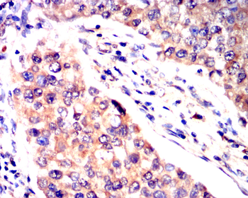 DNM1L Antibody