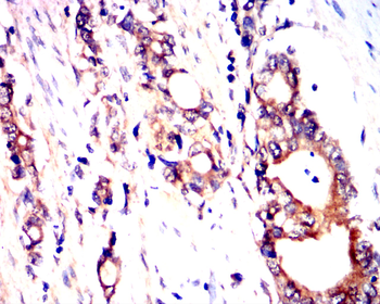 DNM1L Antibody