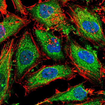 SREBF1 Antibody