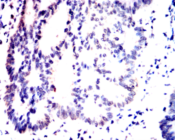 SREBF1 Antibody