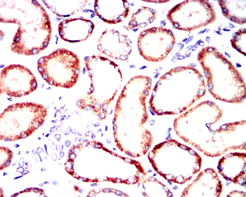 KIT Antibody