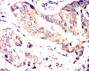 MAP2K1 Antibody