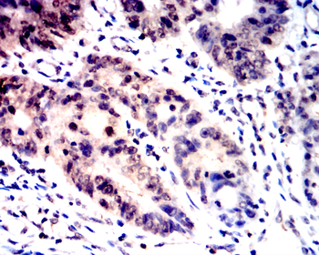 GSDMD Antibody