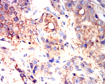 GSDMD Antibody