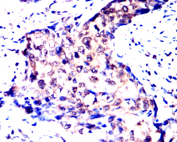 GSDMD Antibody